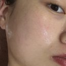 뷰티난다 | 마산 합성동 난다뷰티에서 받은 물방울리프팅 후기! 물광피부 Get✨