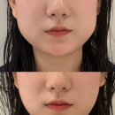 아이디웰 | 전주 에코시티 미용실 두피맞춤 숨스파 케어 고객님의 찐찐후기!