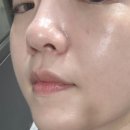 드림 무브 | “열감‧홍조까지 잠재운 트러블 리셋!” 올가드림뷰티 분당피부샵 디톡스 관리 후기 💆‍♀️