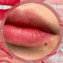 구미 미인점 점타투 재생연고는 몇번?