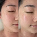 에덴피부관리 | 안산 피부관리 일동 피부관리 추천 에덴 스킨케어 수기 마사지 및 수분 보습케어 찐 후기