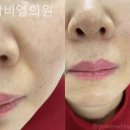 비엘의원 이미지