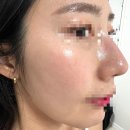 홍조 꿀광 스킨케어루틴 ✨어나더페이스 겔마스크 내돈내산 후기 특가
