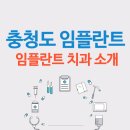충청도 (천안, 청주, 당진) 임플란트 치과 알아보기 (오스템, 네오, 덴티움)