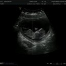 별에서 온 뿌꾸 이미지