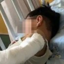 “엄마 오는지 보려” 11층서 추락한 4살 아이, 기적적 생존 이미지