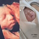 은영침구 | 원주 우리산부인과 제왕절개 후기_1일차(수술과정, 병원시설 안내, 산후회복 후기)