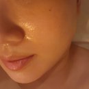 대구 대명역 피부클리닉 리안스킨앤바디 윤곽관리 후기