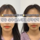 [안동 손수에스테틱] 얼굴 비대칭교정•윤곽관리 후기