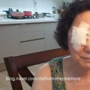 아름다운김현숙안과의원 | 화곡동 안과 백내장 수술후기-서울ㄹㄷㅅ안과
