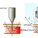 제니센의료기 이미지