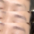 아인뷰티의원 이미지