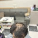 수정헤어샵 | 보령 두피관리 잘하는 미용실｜40대 남성 유전성 탈모, 초콜릿 헤어샵 관리 후기