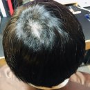 의정부경전철 회룡역 | 회룡역미용실, 회룡역헤드스파, 의정부헤드스파, 호원동헤드스파, 의정부미용실, 두피케어잘하는곳,레드...