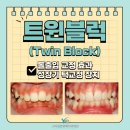 성남예치과병원 | 돌출입 교정에 효과적인 트윈블럭, 과개교합 성장기 턱교정장치 사용 방법과 효과