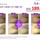 케어셀라 이미지