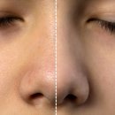 청담아이스피부과의원 이미지