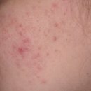 제너리스의원 광명철산 이미지