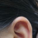 귀건강(이혈테라피) 네이버블로그