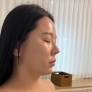 율하 J모터스 | 김해 장유 골드테라피에서 윤곽관리 온다리프팅 10만J 후기