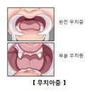 무만 이미지