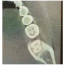 사랑니사랑치과의원 이미지