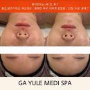 가율메디스파 | [뷰티후기] 학정동피부관리 '가율메디스파' 화이트 토닝케어 후기