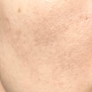 더쉼효소 | BACK AT ONE 젠세럼 내돈내산 꾸준히 써본 실제 후기