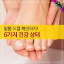 발톱 건강 상태 & 젊음 유지 요가 이미지