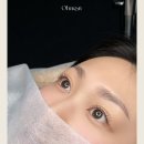 오눈 | 원주 오눈, 속눈썹 펌 시술사례 (원주 속눈썹펌)