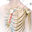 왼쪽 갈비뼈 통증 오른쪽 갈비뼈 통증 원인 비장비대 이미지