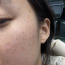 유어라인의원 네이버블로그