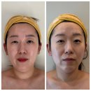 뉴법조타운 | 쌓인 부종, 림프 해독으로 비워내고 탄력까지 꽉! 안양피부관리 벨리온뷰 리얼후기