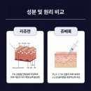귀티나 - 동래구 | 귀티 피부 비밀! 쥬베룩 볼륨(레니스) 효과, 부작용 결절 증상 현실 후기