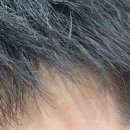 맑은얼굴피부과의원 | 대치동 피부과 신학철피부과의원 후기｜얼굴·몸 붉은 반점 때문에 진료받아봤어요