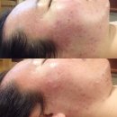 보떼드민 | 수영구피부관리 보떼드민 최고!!