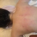 늘솜에스테틱 네이버블로그