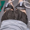 (주)대세엠.케어 | [을지로,명동]엠스컬프네오 허벅지 관리와 명동다이어트약 후기