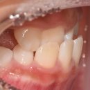 아이퍼스트치과병원 이미지