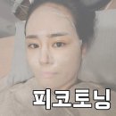 더블에이의원 | 옥수역 피부과 피코하이피코토닝 후기