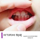 아기 치아착색,상설소대로 삼산동 삼성주니어 다녀온 후기!