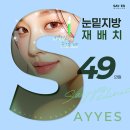 예스비비 | 강남역 눈밑지방재배치 가격 49만원 격막강화+애교살 살리는 눈밑지방재배치후기