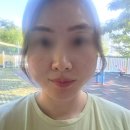 시티세븐한의원에서 창원리프팅 실리프팅 붓기 통증 식사 냉찜질 유경험자의 이야기