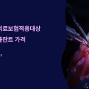 의료법인 소화의원 | 임플란트 의료보험적용대상 / 어금니 임플란트 가격
