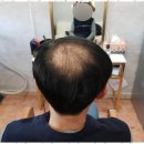 수원-1381 이미지