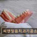 믿음치과기공소 네이버블로그