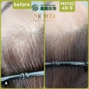 헤어샵오늘 이미지