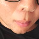 김포춘의생한방병원 | 김포남자수염제모 잘하는 춘의생한방병원