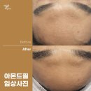 더맑은스킨천안불당점