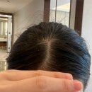 신산약국 | 홈케어 탈모관리 제품 추천 약국 탈모샴푸 후기 효과 가격